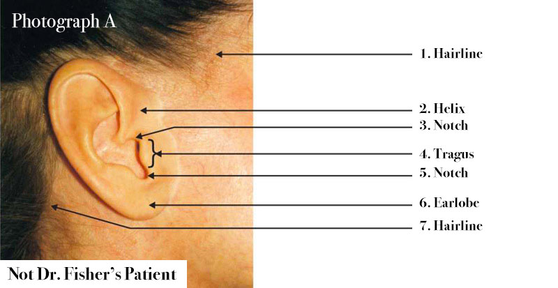 Diagram of side of woman's face