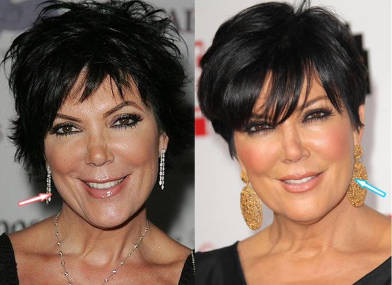Kris Jenner before and after