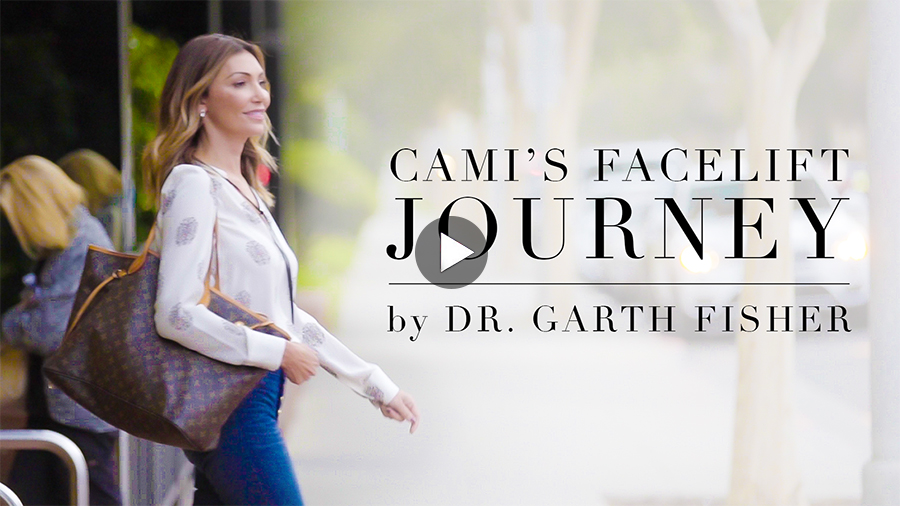 Facelift Beverly Hills | Cami's Journey